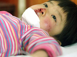 梦见别人小孩或自己的小孩受伤，感到忧愁是什么意思