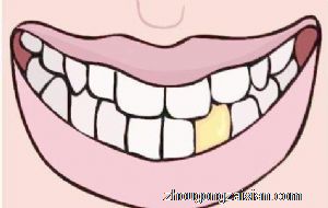 梦见牙龈出血是什么意思