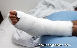 梦见别人腿断了是什么意思