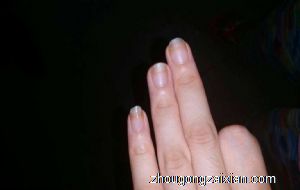 梦见拔手指上的肉刺是什么意思