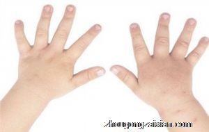 梦见指甲脱落是什么意思