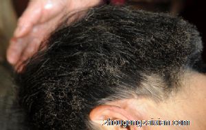 梦见孩子头发被火烧是什么意思