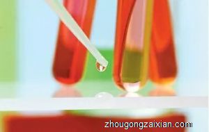 梦见自己在尿血是什么意思