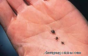 梦见蜱虫咬住大拇指是什么意思