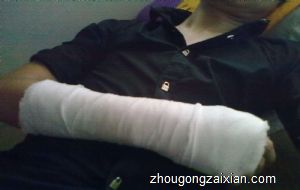 梦见自己右手断了是什么意思