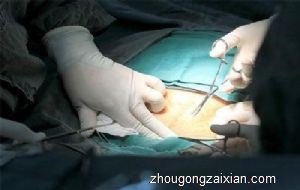 梦见身体开刀是什么意思