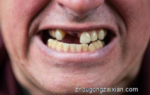 梦见已故父亲掉牙是什么意思