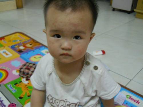 梦见生病的婴儿是什么意思