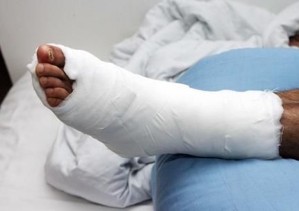 梦见别人腿断了是什么意思