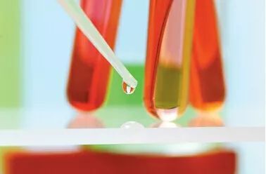 梦见自己在尿血是什么意思