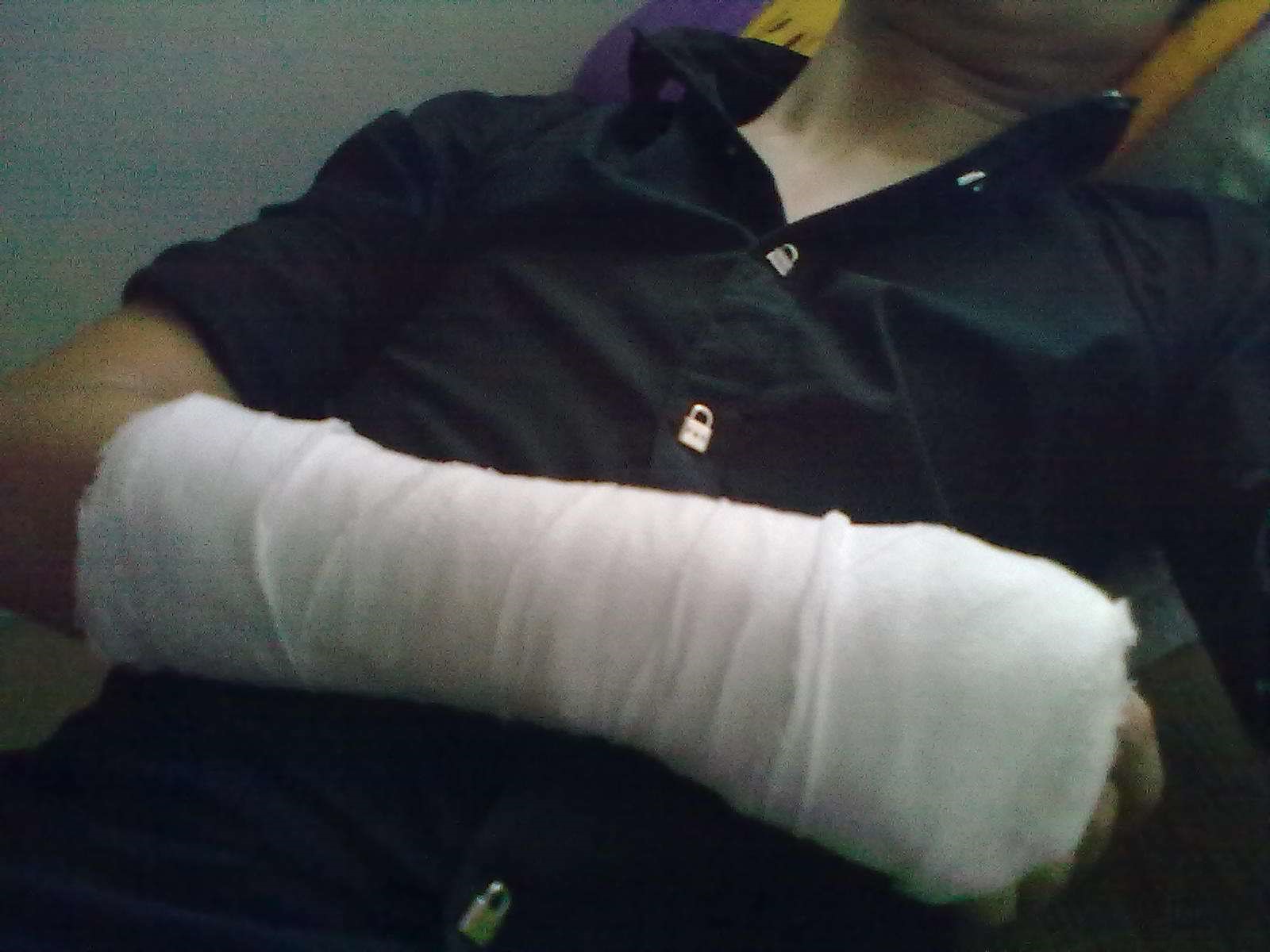 梦见自己右手断了是什么意思