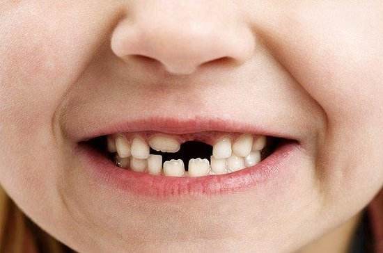 梦见自己牙齿碎了是什么意思